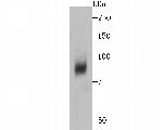 DCP1A Antibody in Western Blot (WB)