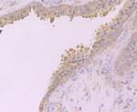 Desmoglein 2 Antibody in Immunohistochemistry (Paraffin) (IHC (P))