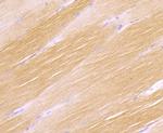 H-cadherin Antibody in Immunohistochemistry (Paraffin) (IHC (P))