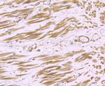 H-cadherin Antibody in Immunohistochemistry (Paraffin) (IHC (P))