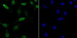 SNRPA Antibody in Immunocytochemistry (ICC/IF)