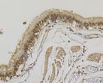 SNRPA Antibody in Immunohistochemistry (Paraffin) (IHC (P))