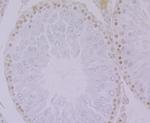 HnRNP Q Antibody in Immunohistochemistry (Paraffin) (IHC (P))