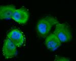 p53DINP1 Antibody in Immunocytochemistry (ICC/IF)