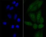p53DINP1 Antibody in Immunocytochemistry (ICC/IF)