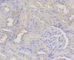 WNK1 Antibody in Immunohistochemistry (Paraffin) (IHC (P))