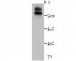 WNK1 Antibody in Western Blot (WB)