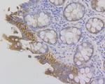 Fibrinogen gamma Antibody in Immunohistochemistry (Paraffin) (IHC (P))