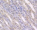 CBF beta Antibody in Immunohistochemistry (Paraffin) (IHC (P))