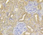 NDUFS4 Antibody in Immunohistochemistry (Paraffin) (IHC (P))