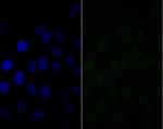 BAF57 Antibody in Immunocytochemistry (ICC/IF)