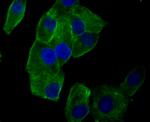 LUM Antibody in Immunocytochemistry (ICC/IF)