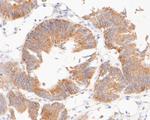 TIMM50 Antibody in Immunohistochemistry (Paraffin) (IHC (P))