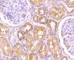 SCN9A Antibody in Immunohistochemistry (Paraffin) (IHC (P))