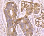 SCN9A Antibody in Immunohistochemistry (Paraffin) (IHC (P))