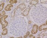 ALDH4A1 Antibody in Immunohistochemistry (Paraffin) (IHC (P))