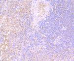 IL-31 Antibody in Immunohistochemistry (Paraffin) (IHC (P))