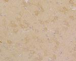 ATF6 Antibody in Immunohistochemistry (Paraffin) (IHC (P))