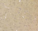 Carbonic Anhydrase II Antibody in Immunohistochemistry (Paraffin) (IHC (P))