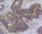 Stathmin 1 Antibody in Immunohistochemistry (Paraffin) (IHC (P))