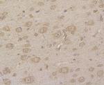 HIP1 Antibody in Immunohistochemistry (Paraffin) (IHC (P))