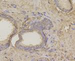 HIP1 Antibody in Immunohistochemistry (Paraffin) (IHC (P))