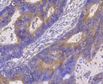 HIP1 Antibody in Immunohistochemistry (Paraffin) (IHC (P))