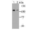 HIP1 Antibody in Western Blot (WB)