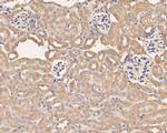 SERPINC1 Antibody in Immunohistochemistry (Paraffin) (IHC (P))