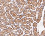 MGST1 Antibody in Immunohistochemistry (Paraffin) (IHC (P))