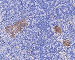 TRIM72 Antibody in Immunohistochemistry (Paraffin) (IHC (P))