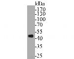 TRIM72 Antibody in Western Blot (WB)