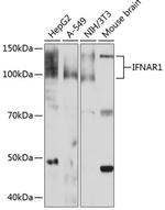 IFNAR1 Antibody in Western Blot (WB)