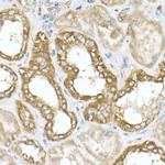 ATP Synthase beta Antibody in Immunohistochemistry (Paraffin) (IHC (P))