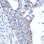 ATP5A1 Antibody in Immunohistochemistry (Paraffin) (IHC (P))