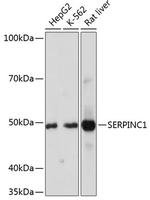 SERPINC1 Antibody in Western Blot (WB)