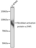 FAP Antibody in Western Blot (WB)