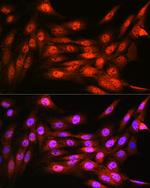 VCP Antibody in Immunocytochemistry (ICC/IF)