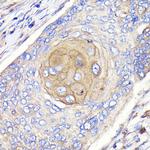 FGFR3 Antibody in Immunohistochemistry (Paraffin) (IHC (P))