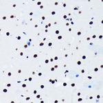 TDP-43 Antibody in Immunohistochemistry (Paraffin) (IHC (P))