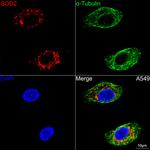 SOD2 Antibody in Immunocytochemistry (ICC/IF)