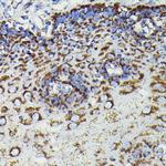 SOD2 Antibody in Immunohistochemistry (Paraffin) (IHC (P))