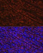 NQO1 Antibody in Immunohistochemistry (Paraffin) (IHC (P))