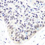 XPO5 Antibody in Immunohistochemistry (Paraffin) (IHC (P))