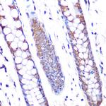 SKP2 Antibody in Immunohistochemistry (Paraffin) (IHC (P))