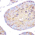 CD49d (Integrin alpha 4) Antibody in Immunohistochemistry (Paraffin) (IHC (P))