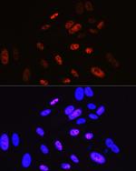 Cyclin H Antibody in Immunocytochemistry (ICC/IF)