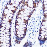 MAOA Antibody in Immunohistochemistry (Paraffin) (IHC (P))