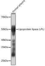 LPL Antibody in Western Blot (WB)