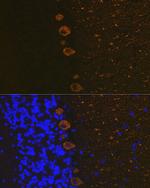 IP3 Receptor 1 Antibody in Immunohistochemistry (Paraffin) (IHC (P))